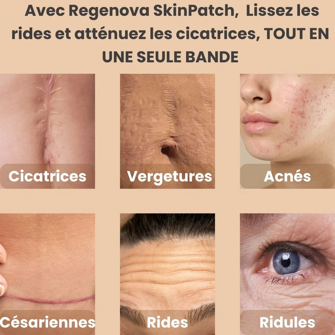 Regenova SkinPatch